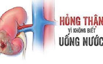 Bác sĩ tiết niệu chỉ ra 6 thói quen âm thầm 'phá hỏng' thận